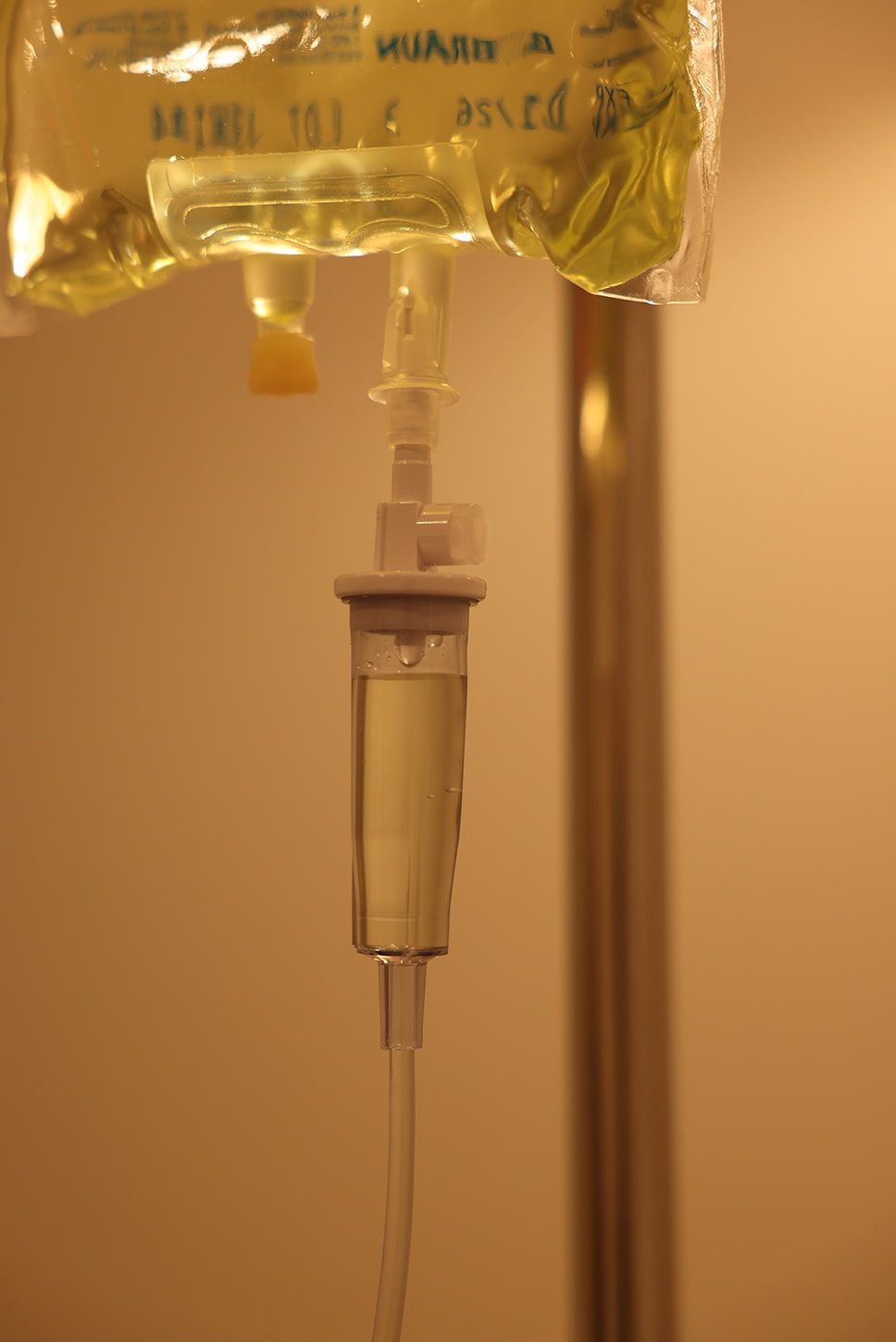 IV bag and drip setup in medical environment.