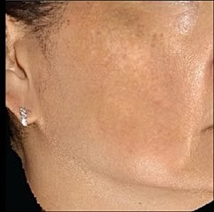 Sylfirm X Gallery Before & After