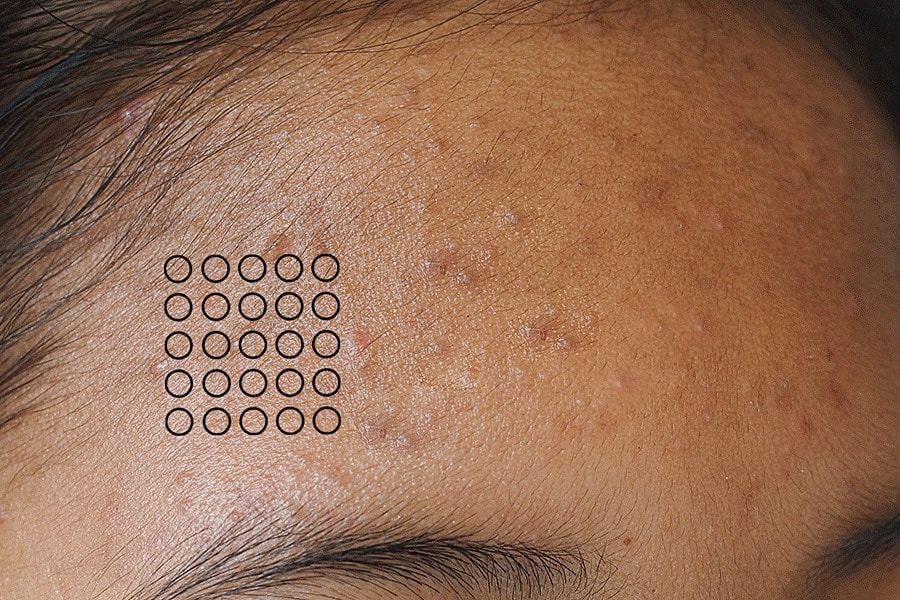 Sylfirm X Gallery Before & After