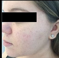 Sylfirm X Gallery Before & After