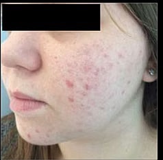 Sylfirm X Gallery Before & After