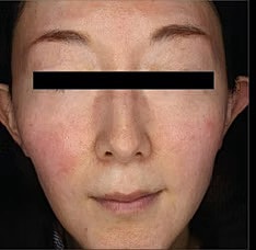 Sylfirm X Gallery Before & After