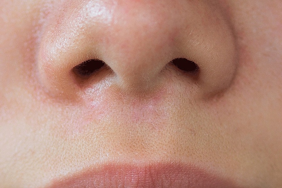 Sylfirm X Gallery Before & After