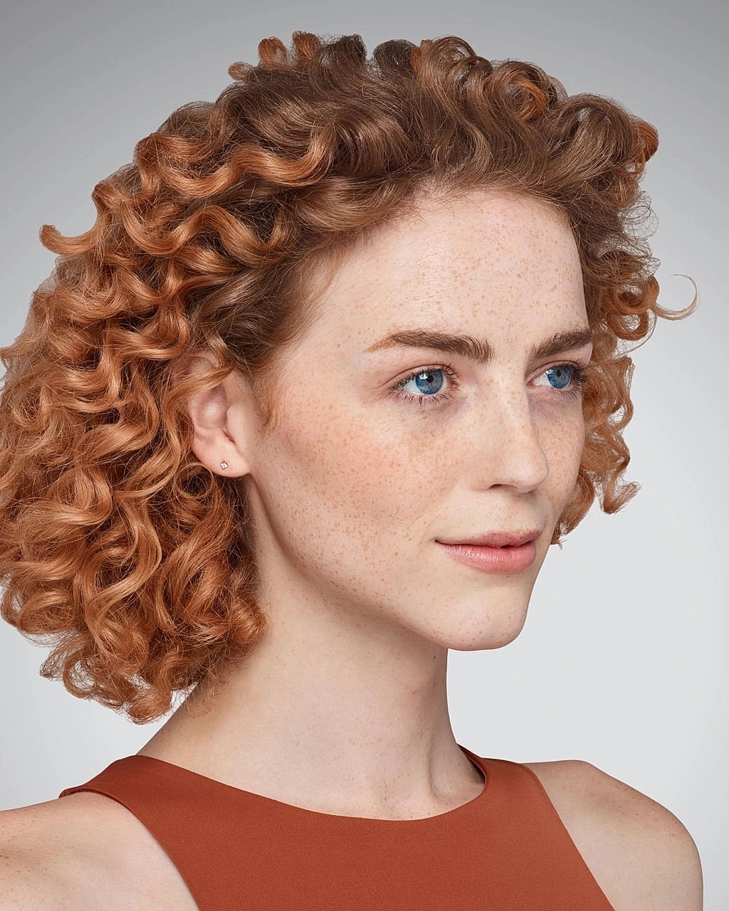 Juvederm Gallery Before & After