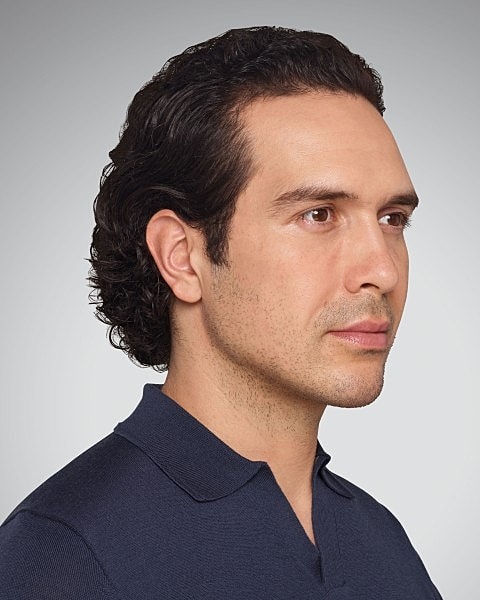 Juvederm Gallery Before & After