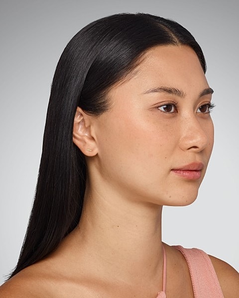 Juvederm Gallery Before & After