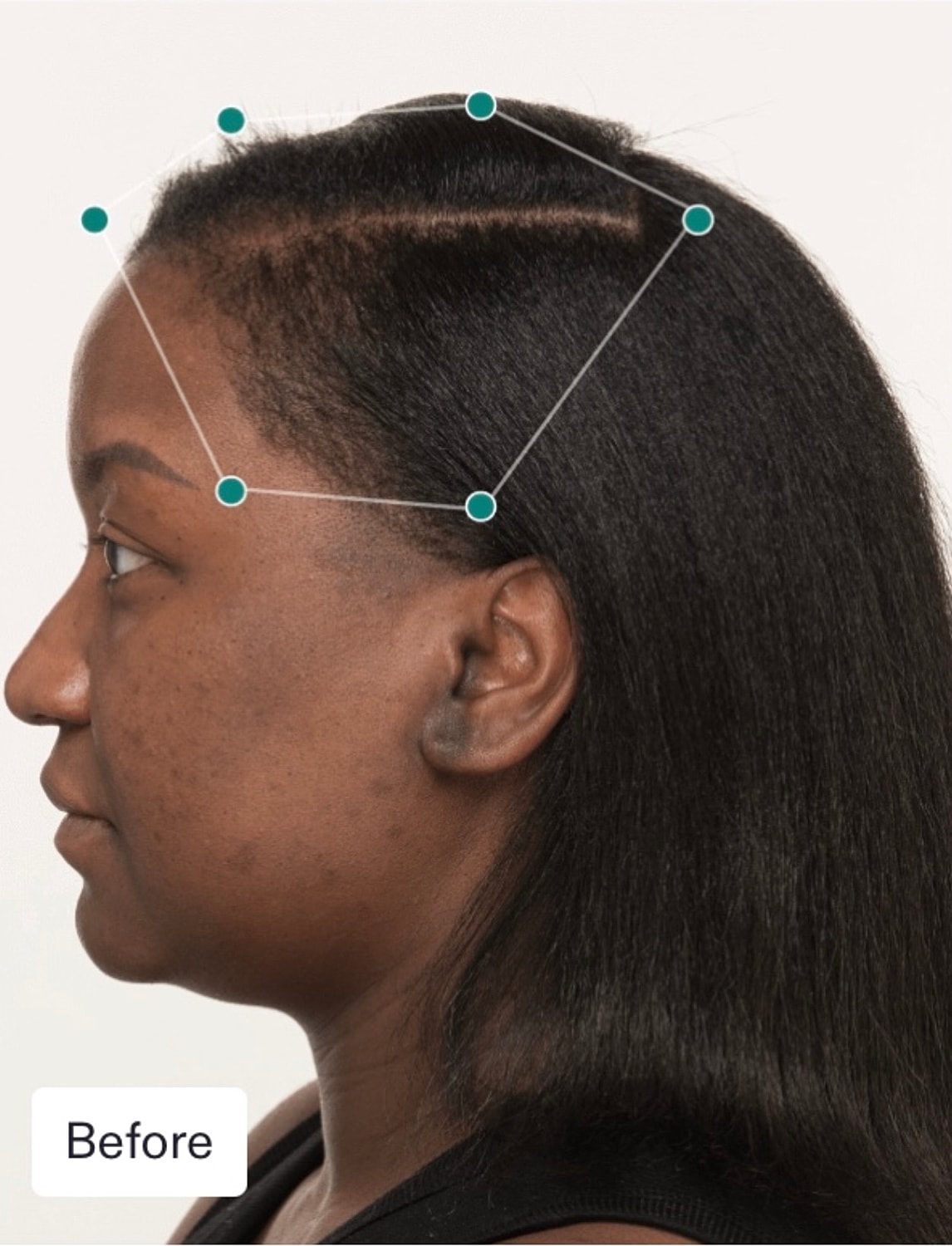 Nutrafol Gallery Before & After